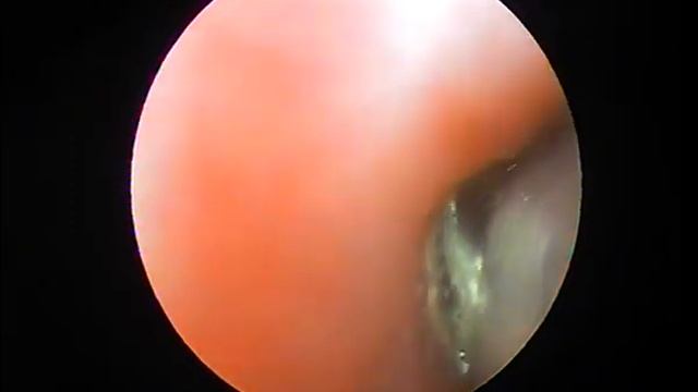 Эндоскопия Ветеринарная клиника "Ветдоктор" Воронеж. смотреть онлайн