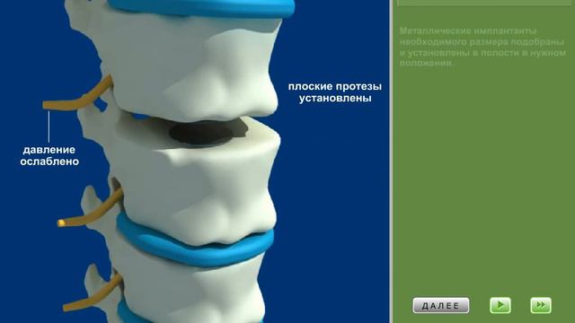 Полное замещение диска смотреть онлайн