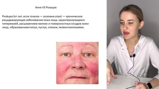 Модуль 2. Урок 3. Основные дерматовенерологические заболевания. смотреть онлайн