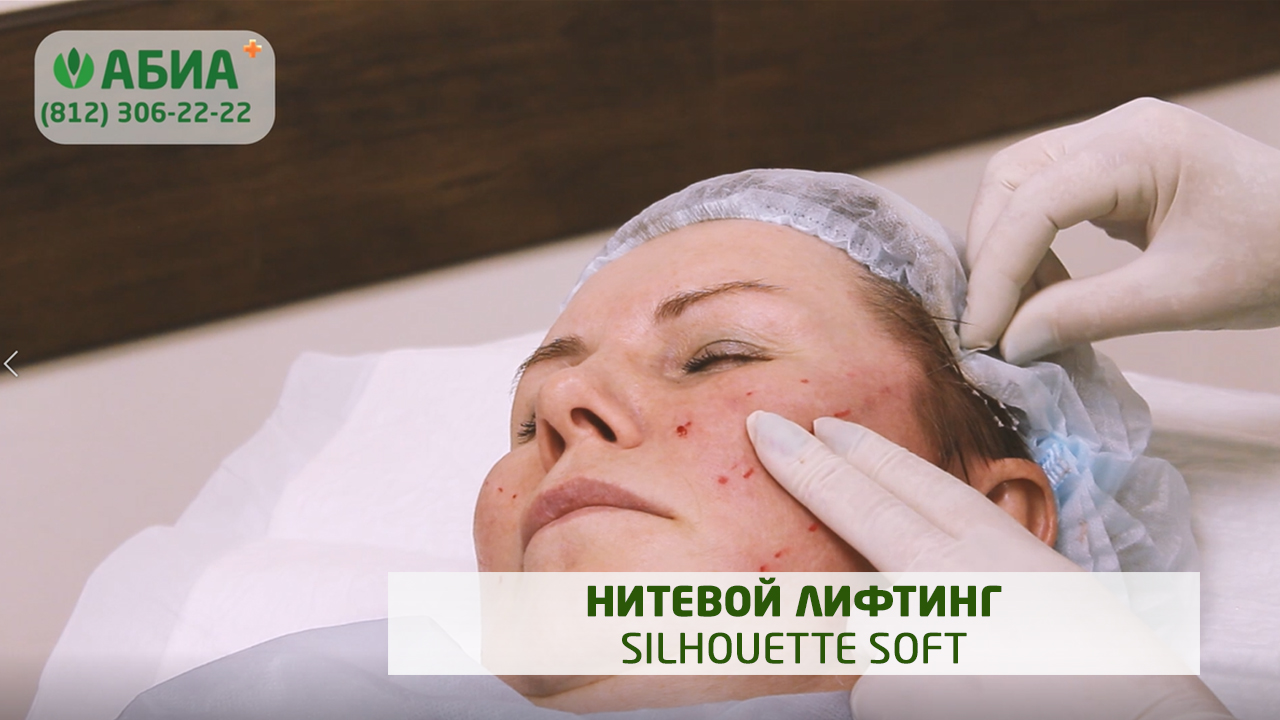 Нитевой лифтинг Silhouette Soft