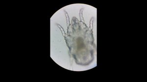 Ушной клещ под микроскопом, отодектоз, ушная чесотка