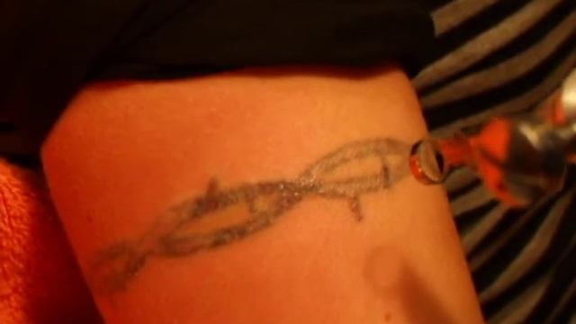 Заличаване на татуировка вита смотреть онлайн
