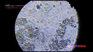 Бактерии зубного налёта под микроскопом "АНАЛИТ" MICRO WORLD #3