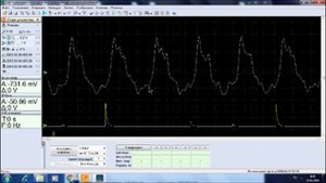 Датчик разряжения в диагностике автомобиля.