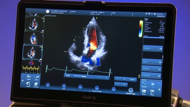 Vivid Iq Product Demonstration | GE Healthcare