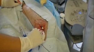 Процедура РЧО учебное видео 1