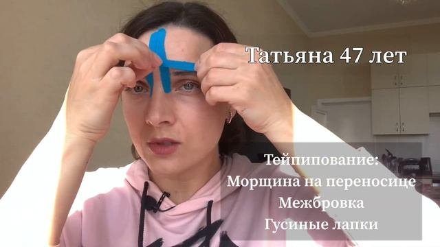 Тейпирование морщин!