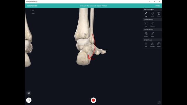 Стельки ФормТотикс: порядок, показания и особенности изготовления смотреть онлайн