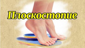 Плоскостопие.mp4