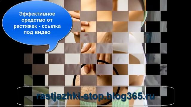 Лазерная шлифовка растяжки отзывы
