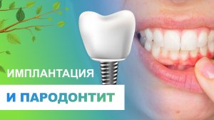 ? Имплантация и пародонтит