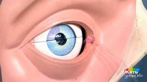 Почему вы постоянно плачете? Жить здорово! Фрагмент выпуска от 17.05.2017