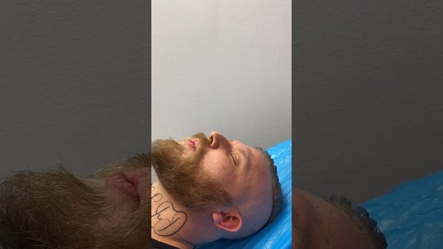 Apadravya reaction!!! смотреть онлайн