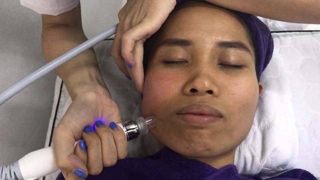 6 in 1 hydro peeling skin rejuvenation machine D06B. смотреть онлайн