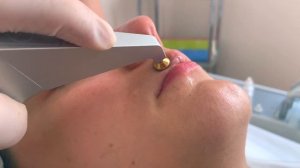 Процедура на аппарате OxyJet Leo DeLuxe от Nora Bode