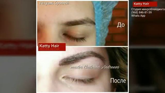 Микроблейдинг Фото до и после. смотреть онлайн