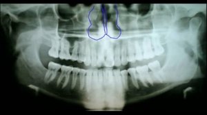 Панорамный снимок