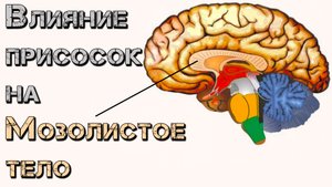 Воздействие присосок от тёмных на Мозолистое тело