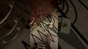 Пяточная шпора.Мой метод лечения.
