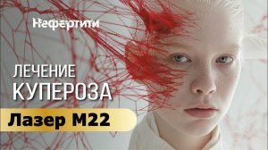 Лечение купероза на лице аппаратом М22 в Хабаровске