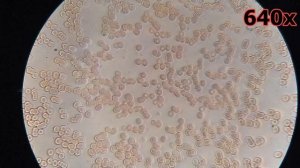 Кровь после чёрного чая