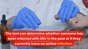 The 5 Things You MUST Know about Epstein-Barr Virus (EBV) in 2023