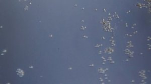 Споры плесени под микроскопом