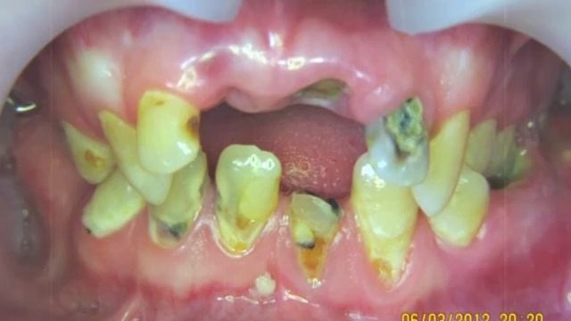 Кафедра детской хирургической стоматологии и челюстно лицевой хирургии