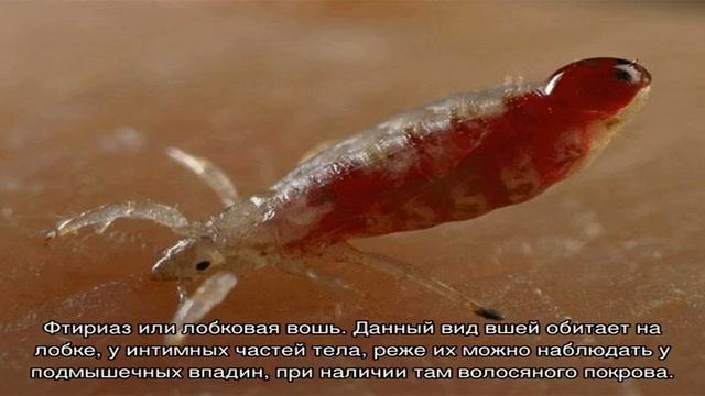 Как выглядят укусы вшей на голове смотреть онлайн