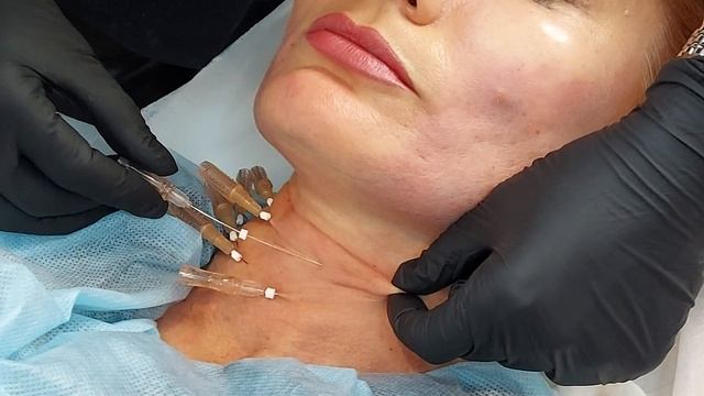 7.02 Нити.Шея(фрагмент) смотреть онлайн