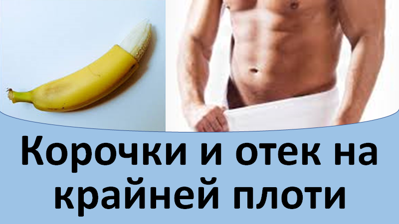 Корочки и отек на крайней плоти