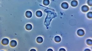 Нейтрофил фагоцитирует бактерию / Bacterial phagocytosis by neutrophil