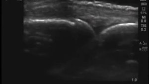 Порядок выполнения: ультразвуковое исследование кисти руки