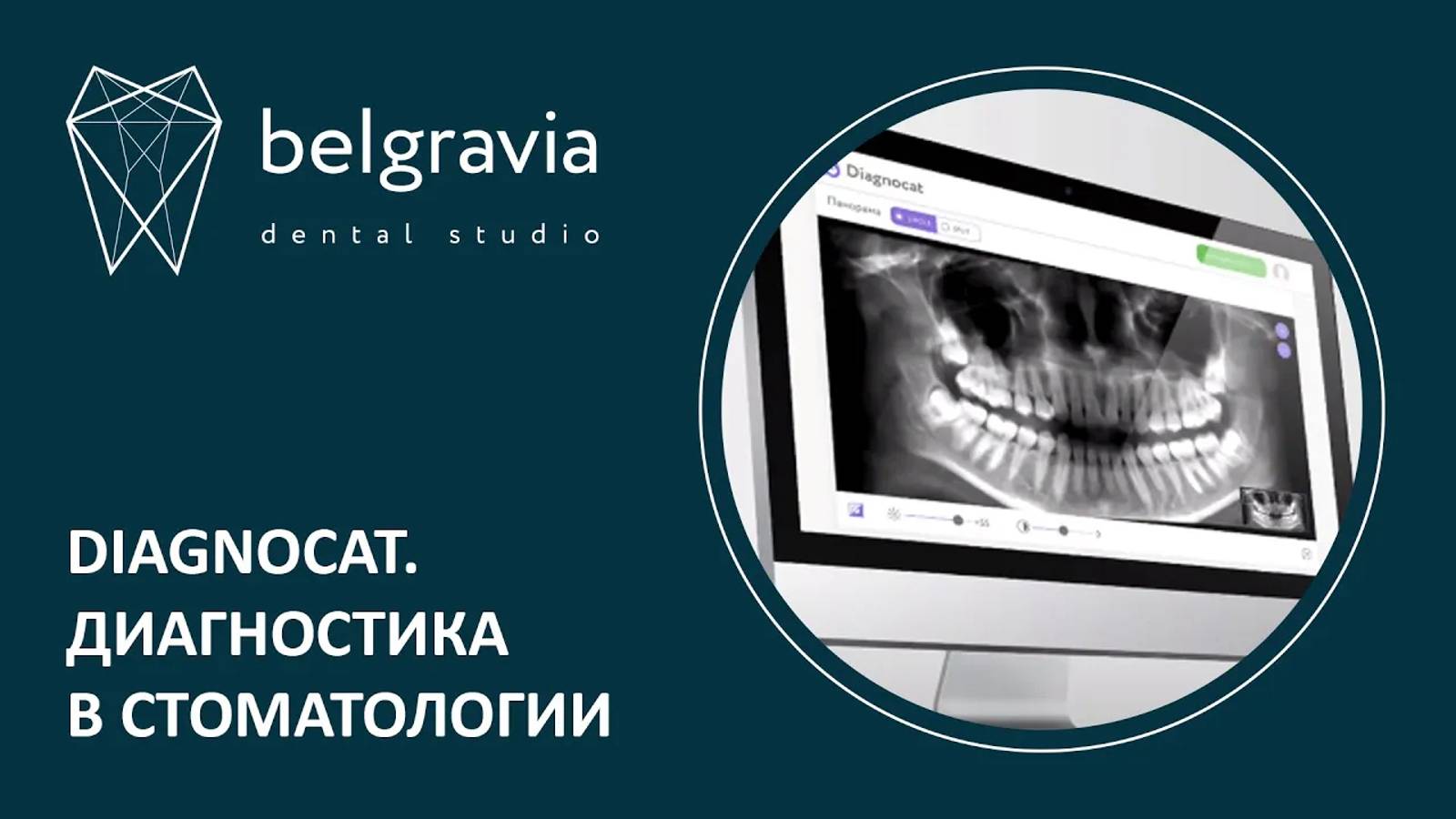 💻 Diagnocat. Диагностика в стоматологии