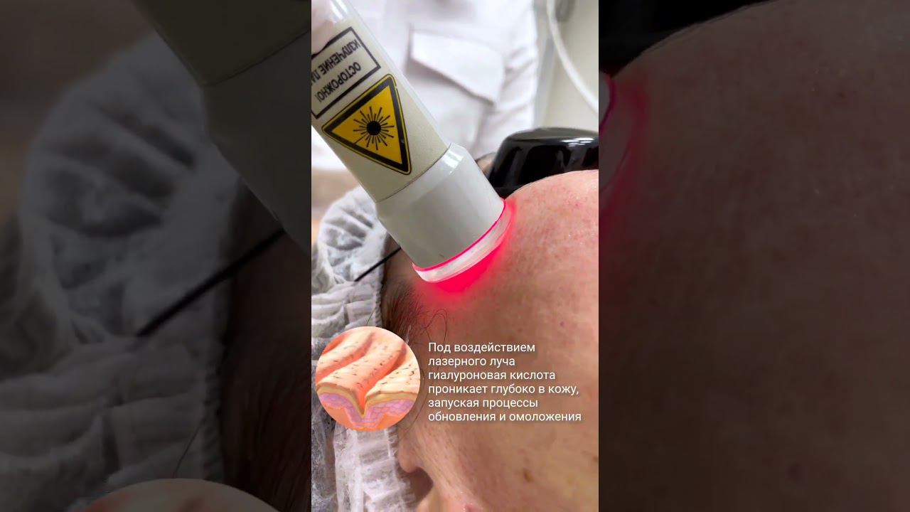 Увлажняем кожу без уколов! смотреть онлайн