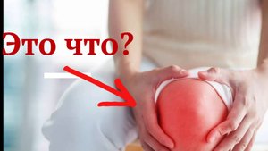 Гонартроз коленного сустава Что Это Такое