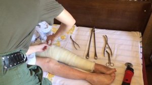 Снятие пластикового гипса при помощи осцилляторной пилы