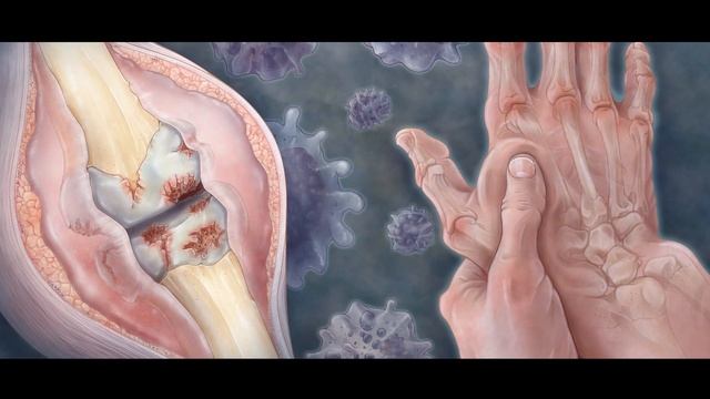 Биоэнергомассажер  Fohow смотреть онлайн