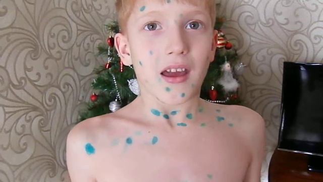 Костюм ветрянка