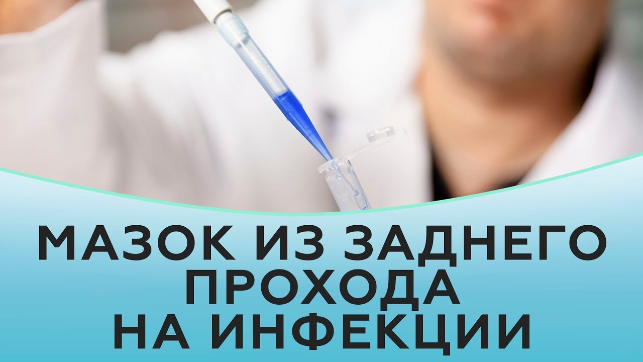 Как взять мазок из заднего прохода на инфекции?