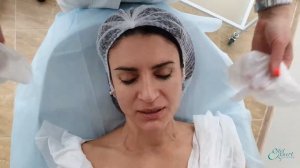 PLASMOLIFTING ÎN MEDICINA ESTETICĂ ?