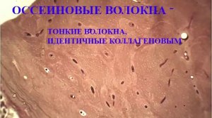 Гистологический препарат "Пластинчатая костная ткань"