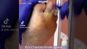 КАРТ в действии