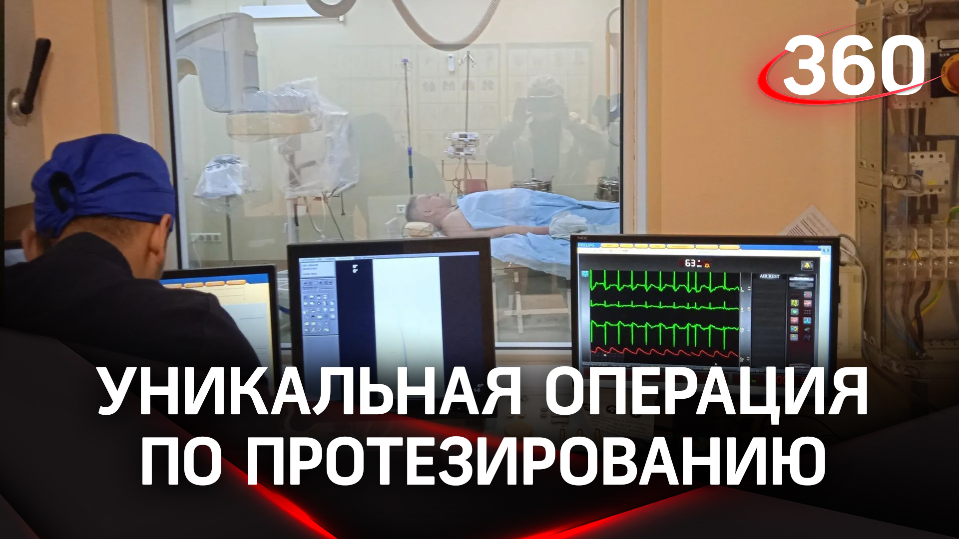 Сосудистые хирурги из Жуковского впервые провели уникальную операцию, которая спасает жизнь