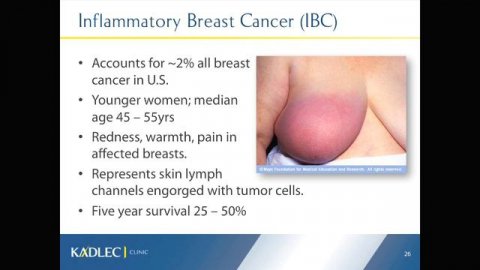 Breast Cancer Seminar