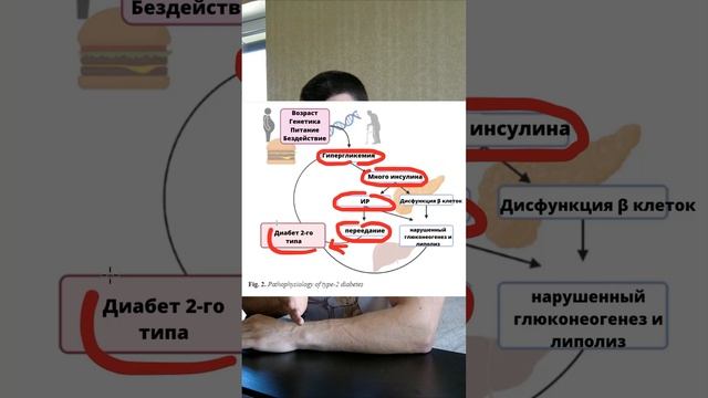 Как избавиться от инсулинорезистентности?