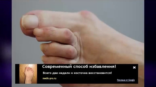 болезни лечение ног