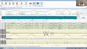 Мастер-класс «Ночное ПСГ-исследование: методика проведения и анализ данных»