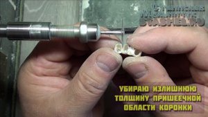 Пластмассовые зубные коронки. ч.5. Обработка и полировка пластмассовых коронок, зубного мостика.