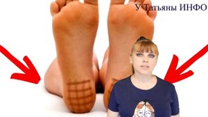 Что будет, если нанести СЕТОЧКУ из ЙОДА на ПЯТКИ???